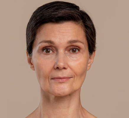 1690279037_Before Botox.png
